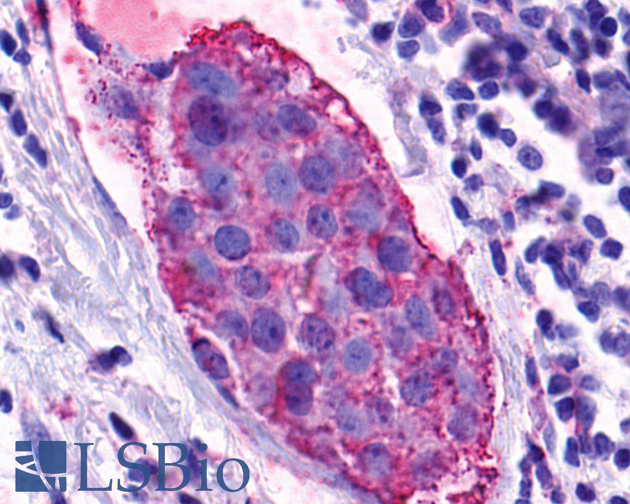 GPR139 Antibody - Breast, carcinoma