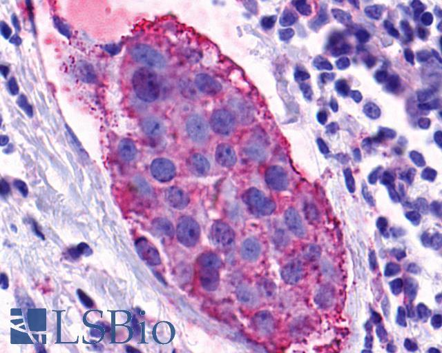 GPR139 Antibody - Breast, carcinoma
