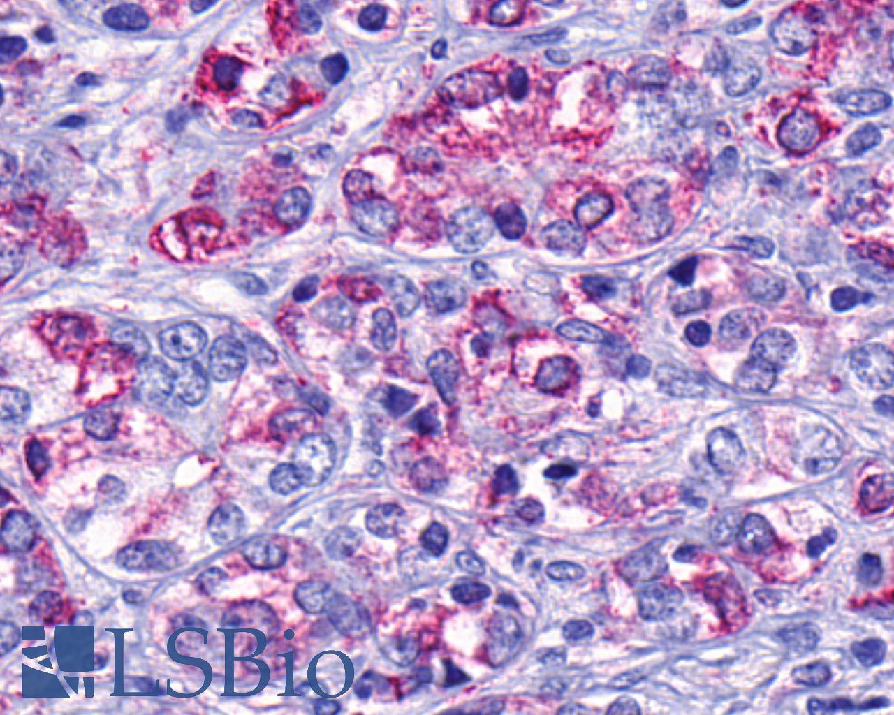 GPR139 Antibody - Prostate, Carcinoma