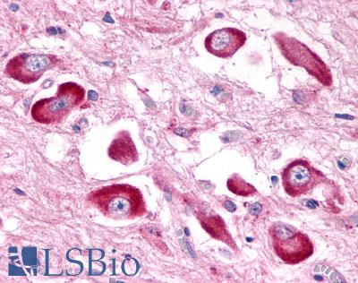 GPR146 Antibody - Brain, Hypothalamus