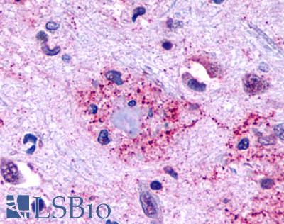 GPR146 Antibody - Brain, Alzheimer's disease, senile plaque
