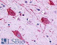 GPR146 Antibody - Brain, Cortex, Neurons and glia