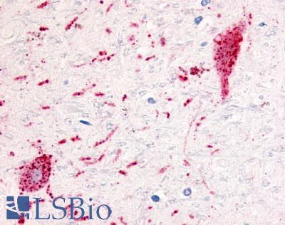 GPR151 Antibody - Brain, substantia nigra