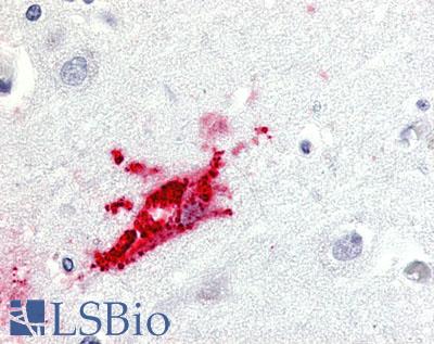 GPR151 Antibody - Brain, Alzheimer's Disease neurons and glia