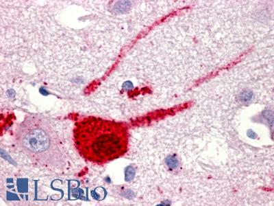 GPR151 Antibody - Brain, Cortex, Neurons and Glia