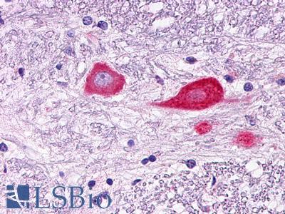 GPR151 Antibody - Brain, Medulla