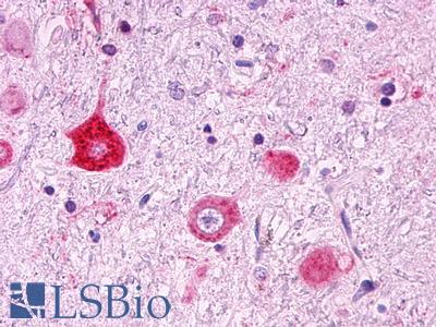 GPR151 Antibody - Brain, Thalamus