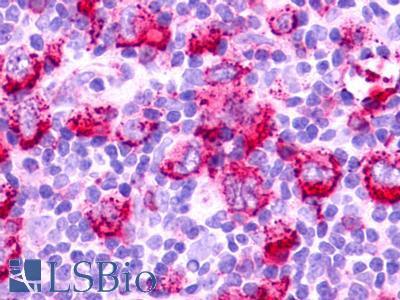 GPR152 Antibody - Hodgkin's lymphoma