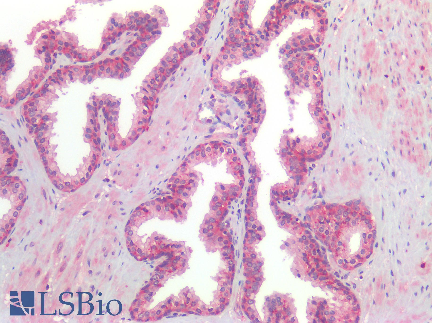 GPR160 Antibody - Human Prostate, Positive Staining in Glandular Acini Cells: Formalin-Fixed, Paraffin-Embedded (FFPE)