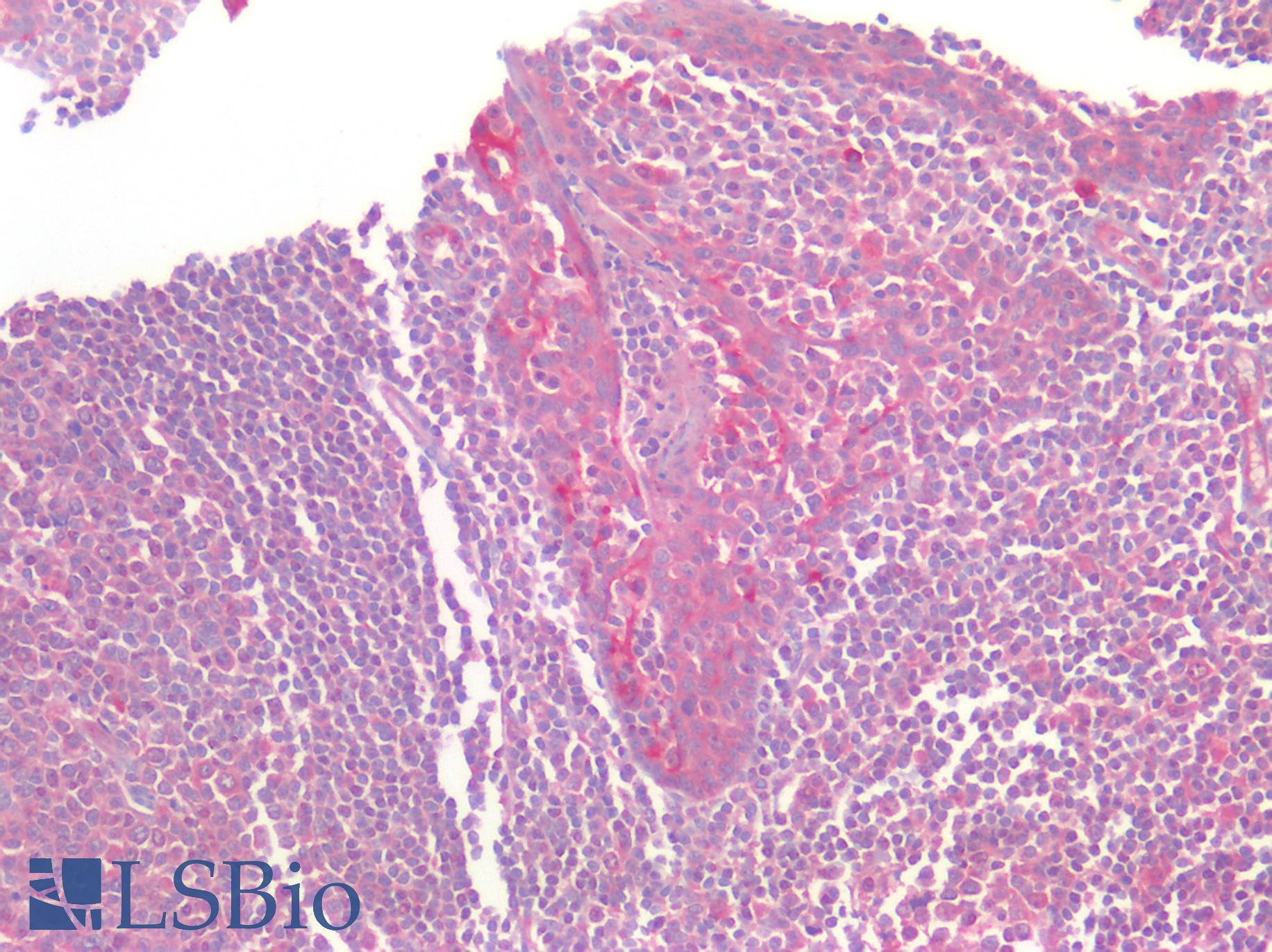 GPR160 Antibody - Human Tonsil: Formalin-Fixed, Paraffin-Embedded (FFPE)