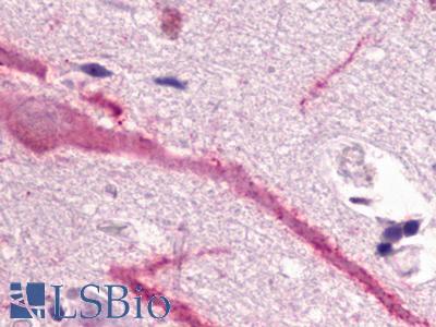 GPR160 Antibody - Brain, Cortex, Neurons and glia