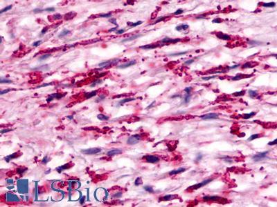 GPR160 Antibody - Brain, Glioblastoma