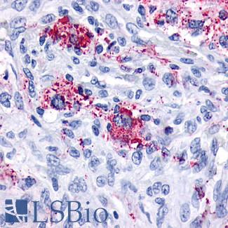GPR161 Antibody - Brain, glioblastoma