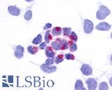 GPR161 Antibody - Anti-GPR161 antibody immunocytochemistry (ICC) staining of HEK293 human embryonic kidney cells transfected with GPR161.