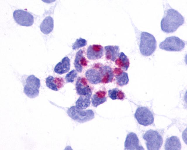 GPR161 Antibody - Anti-GPR161 antibody immunocytochemistry (ICC) staining of HEK293 human embryonic kidney cells transfected with GPR161.