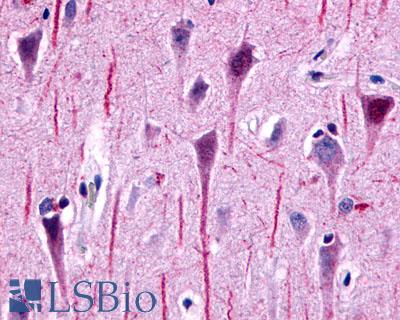 GPR162 Antibody - Brain, Hippocampus, CA1