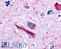 GPR162 Antibody - Brain, Alzheimer's disease, neurofibrillary tangles and granulovacuolar degeneration