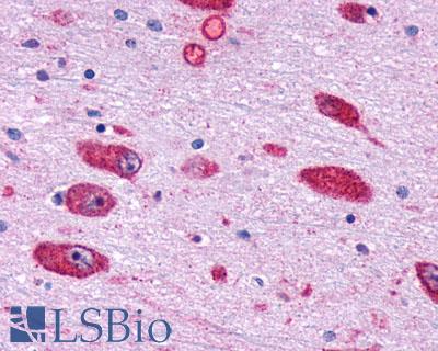 GPR162 Antibody - Brain, Hypothalamus, Dorsomedial Nucleus