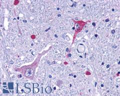 GPR162 Antibody - Brain, Medulla, Solitary Nucleus