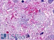 GPR173 / SREB3 Antibody - Brain, Alzheimer's disease, senile plaque