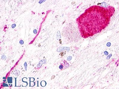 GPR173 / SREB3 Antibody - Brain, Globus Pallidus