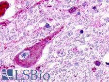 GPR176 Antibody - Brain, Medulla