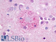 GPR176 Antibody - Brain, Alzheimer's disease, senile plaque