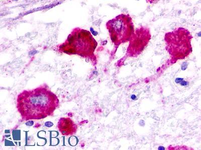 GPR183 / EBI2 Antibody - Brain, Medulla