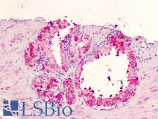 GPR183 / EBI2 Antibody - Human Prostate: Formalin-Fixed, Paraffin-Embedded (FFPE)
