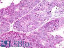 GPR19 Antibody - Ovary, carcinoma