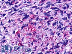 GPR19 Antibody - Brain, Glioblastoma