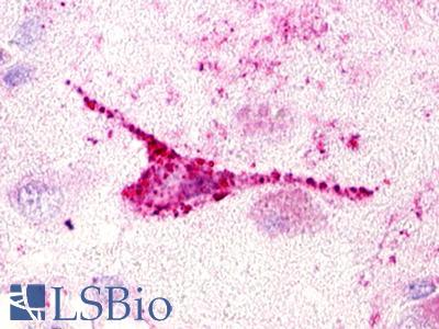 GPR20 Antibody - Brain, Amygdala neuron