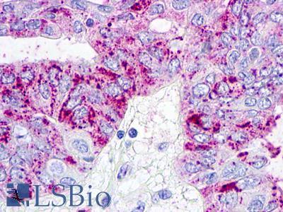 GPR26 Antibody - Ovary, carcinoma