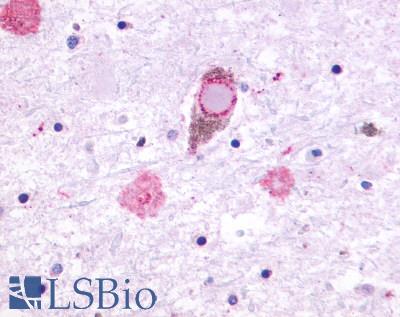 GPR27 Antibody - Brain, Parkinson's disease, Lewy Body