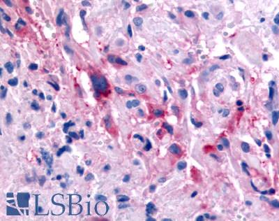 GPR32 Antibody - Brain, Glioblastoma