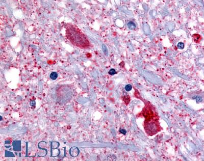 GPR32 Antibody - Brain, Medulla, spinal trigeminal nucleus