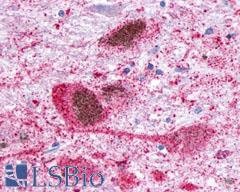 GPR34 Antibody - Brain, substantia nigra