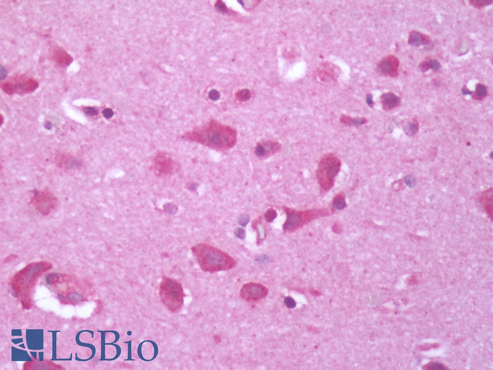 GPR34 Antibody - Human Brain, Cortex: Formalin-Fixed, Paraffin-Embedded (FFPE)