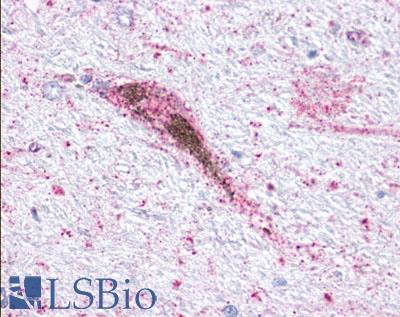 GPR34 Antibody - Brain, substantia nigra