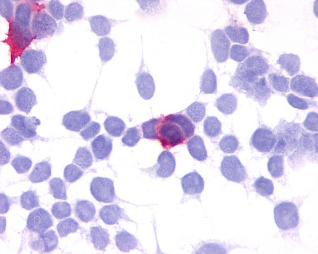 GPR35 Antibody - Anti-GPR35 antibody immunocytochemistry (ICC) staining of HEK293 human embryonic kidney cells transfected with GPR35.