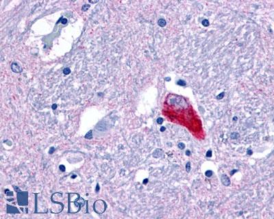 GPR35 Antibody - Brain, Thalamus, neuron