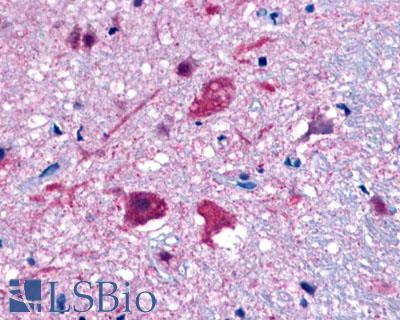 GPR35 Antibody - Brain, HypothalamusBrain, Hypothalamus