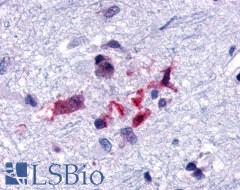GPR44 / CRTH2 Antibody - Brain, Alzheimer's disease senile plaque