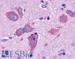 GPR44 / CRTH2 Antibody - Brain, Amygdala