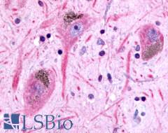 GPR45 Antibody - Brain, substantia nigra
