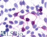 GPR45 Antibody - Anti-GPR45 antibody immunocytochemistry (ICC) staining of HEK293 human embryonic kidney cells transfected with GPR45.
