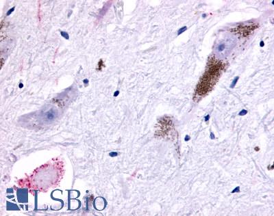 GPR45 Antibody - Brain, substantia nigra