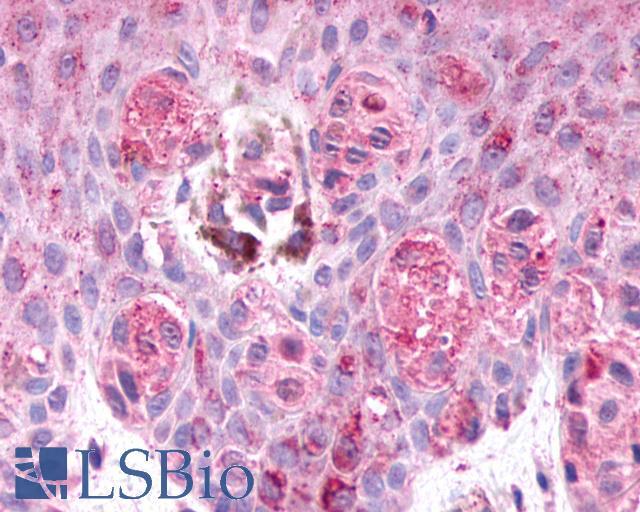 GPR48 / LGR4 Antibody - Skin, Malignant Melanoma