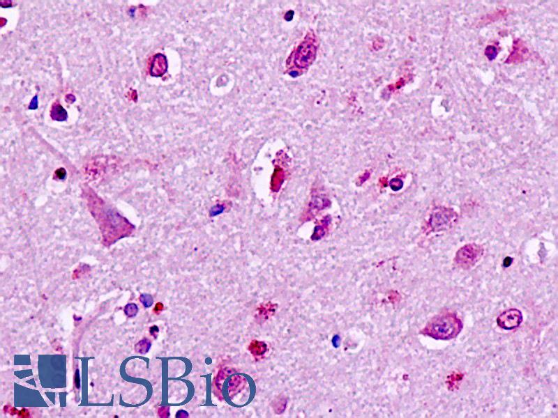 GPR49 / LGR5 Antibody - Human, Brain, neurons: Formalin-Fixed Paraffin-Embedded (FFPE)