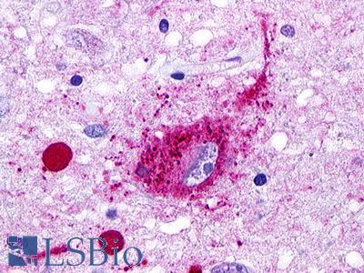 GPR49 / LGR5 Antibody - Brain, hypothalamus, Neuron